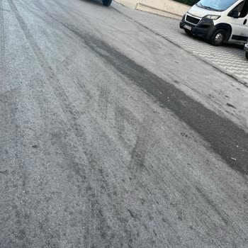 Pasinler Caddesi Ve Kanuni Mahallesi'nde Çöp Kokusu Ve Kirlilik Sorunu