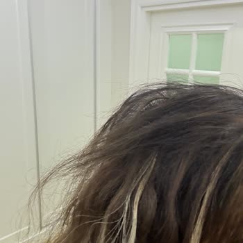 Zeynep Peruk Takılan Saçların Tamamı Koptu