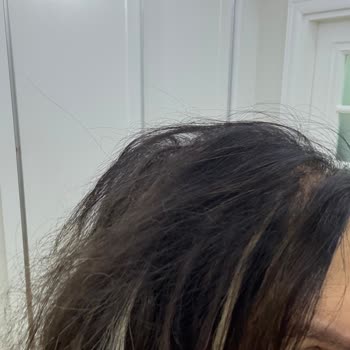 Zeynep Peruk Takılan Saçların Tamamı Koptu