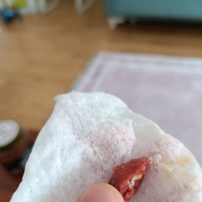 Dana Sucuğun İçinden Kıl Çıkması Hijyen Ve Çocuk Sağlığını Tehdit Etti