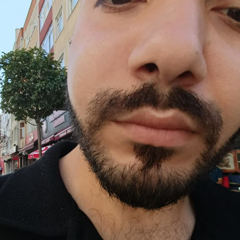 Yanlış Yapılan Diş Tedavisi Sonrası Sağlık Ve Maddi Mağduriyet