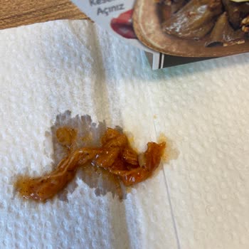 Zel Global Patlıcanın İçinden Kocaman Bir İp Çıktı