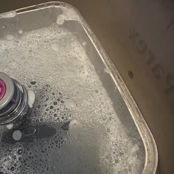 Parex Wondero Temizlik Seti Şeffaf Kapak Sorunu Ve Müşteri Hizmetlerine Ulaşılamıyor