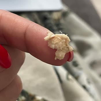 Dondurmanın İçinden Yabancı Madde Çıktı, Sağlığım Tehlikeye Girdi