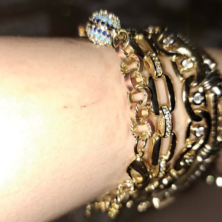 Kısa Sürede Renk Atan Bileklik Ve İlgisiz Müşteri Hizmetleri Hayal Kırıklığı