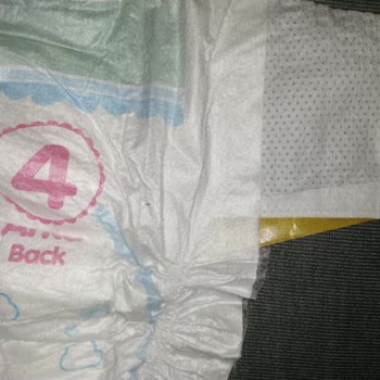 Bebek Bezinde Keskin Yabancı Cisim Çıktı, Kullanılamaz Durumda