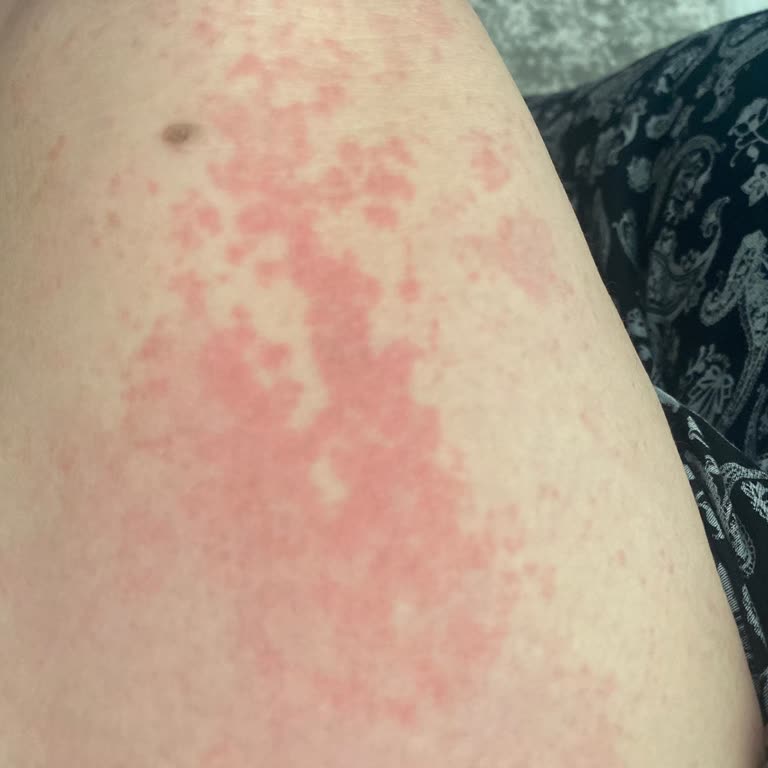 Acil Serviste İlgisizlik Ve Yanlış Yönlendirme Mağduriyeti