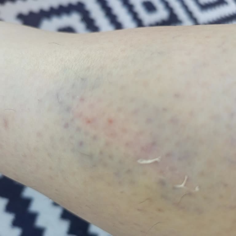 Watsons Mağazasında Koliler Nedeniyle Yaralanma Ve Çalışan İlgisizliği