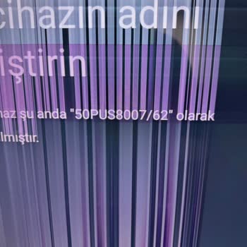 Philips Televizyonumda Ekran Kararması Ve Teknik Servis İlgisizliği