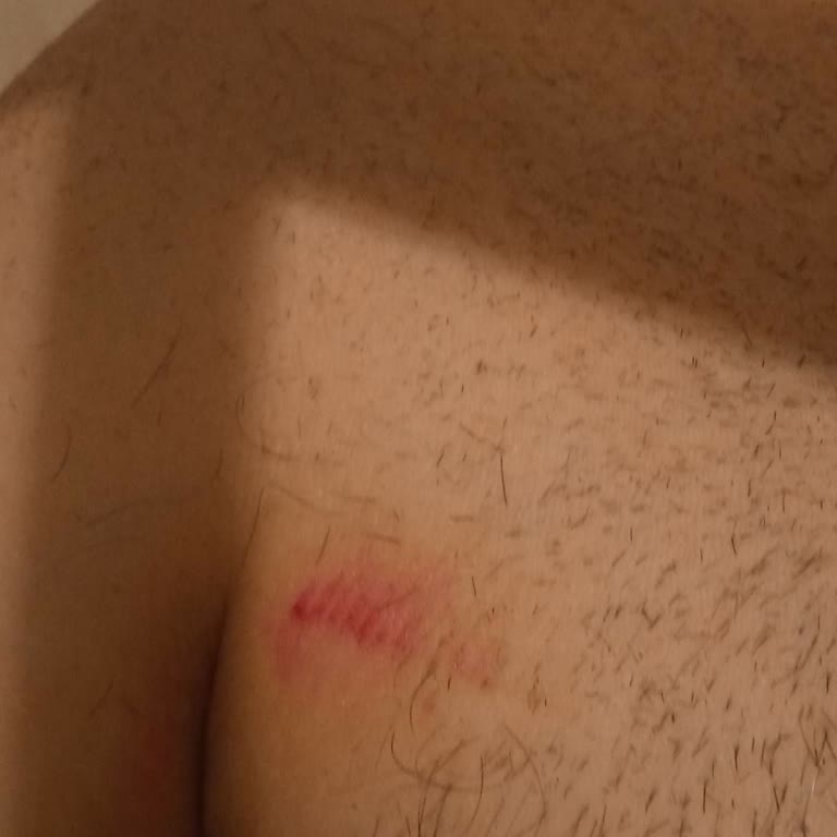 Kusurlu Tıraş Makinesi Ve İade Sorunu