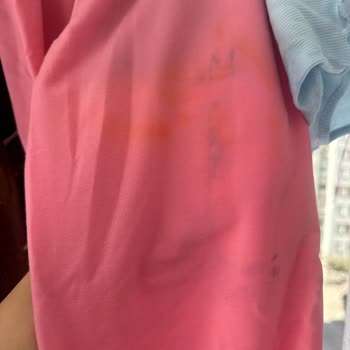 Yıkama Sonrası Morluk Oluşan Ürünler Ve Müşteri Hizmetlerine Ulaşılamıyor