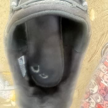 Skechers Ayakkabının Tabanı 2 Ayda Patladı Ve İnceleme Yetersizdi
