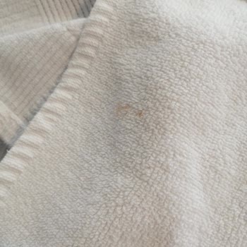 Otel Odasında Temizlik Ve Kapı Sorunu Çözülmedi Mağduriyetim Devam Ediyor