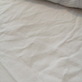 Otel Odasında Temizlik Ve Kapı Sorunu Çözülmedi Mağduriyetim Devam Ediyor