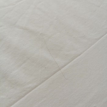 Otel Odasında Temizlik Ve Kapı Sorunu Çözülmedi Mağduriyetim Devam Ediyor