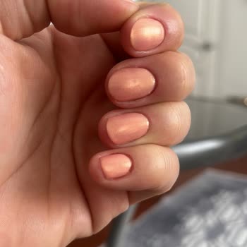 Hijyen Eksikliği Ve Uzman Olmayan Personel Nedeniyle Mağduriyet Yaşadım