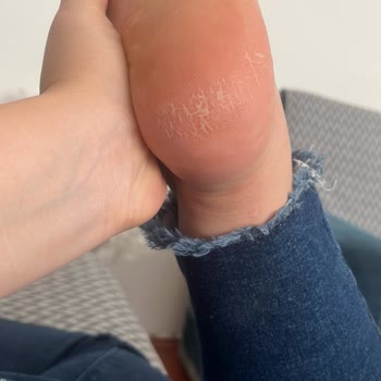 Hijyen Eksikliği Ve Uzman Olmayan Personel Nedeniyle Mağduriyet Yaşadım