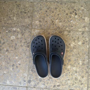 Crocs Terlikte Kısa Sürede Şekil Bozukluğu Ve Müşteri Hizmetlerinden Olumsuz Yanıt