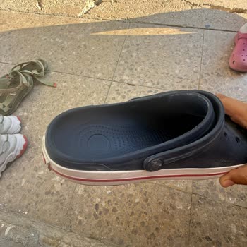 Crocs Terlikte Kısa Sürede Şekil Bozukluğu Ve Müşteri Hizmetlerinden Olumsuz Yanıt