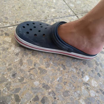 Crocs Terlikte Kısa Sürede Şekil Bozukluğu Ve Müşteri Hizmetlerinden Olumsuz Yanıt
