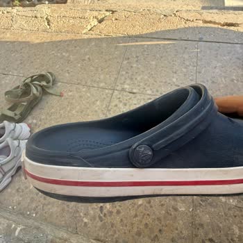 Crocs Terlikte Kısa Sürede Şekil Bozukluğu Ve Müşteri Hizmetlerinden Olumsuz Yanıt