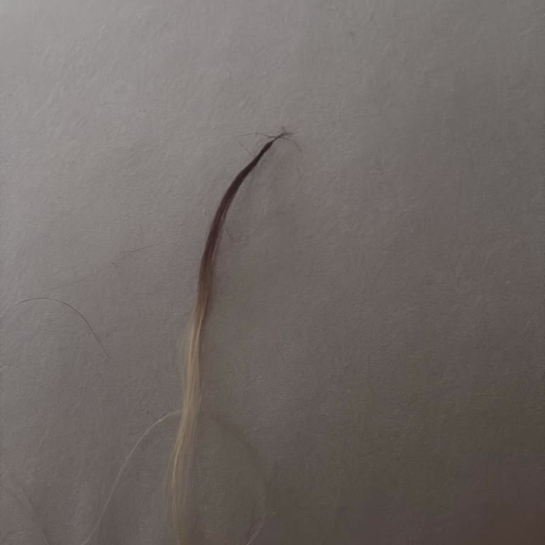 Saç Kaynak İşleminde Aldatıldım, Hem Maddi Hem Manevi Mağdur Oldum