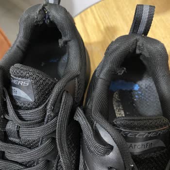 Skechers Ayakkabım Kısa Sürede Deforme Oldu