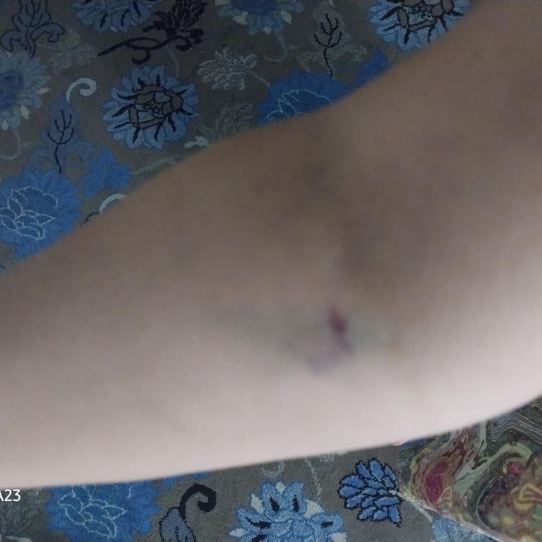 Otelde Hijyen Eksikliği Ve Yaygın Hastalık Nedeniyle Tatilimiz Zehir Oldu