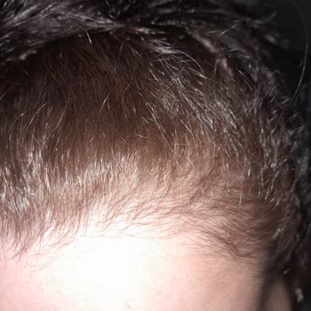 Loreal Paris Saç Boyası Beklenmeyen Renk Ve Beyaz Kapatmama Sorunu