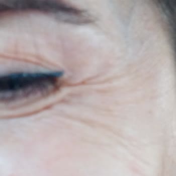 Op. Dr. Başak Çaypınar'da Yaptırdığım İşlem İşe Yaramadı