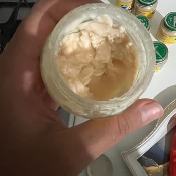 Bebelac Sütlaç Sonrası Bebeğimde Ciddi Sağlık Sorunu Ve Mağduriyet