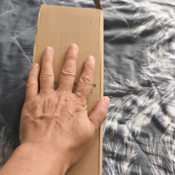 Eksik Gönderilen Ürün Ve Yetersiz Destek Süreci