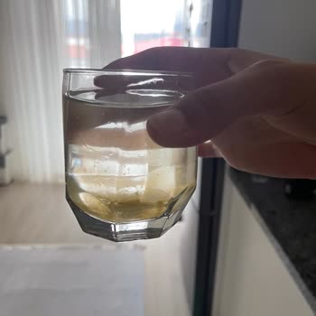 Yosunlu Damacana Su Nedeniyle Sağlık Sorunu Ve İlgisiz Şube