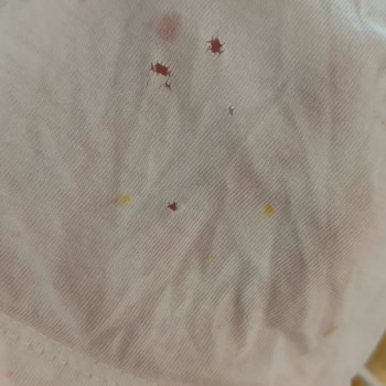 Vestel Çamaşır Makinesi Elbiselerimi Yırtıyor Mağdurum