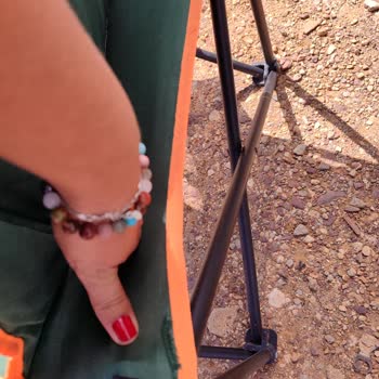 Satın Aldığım Sandalyede Kumaş Açılması Ve Garanti Kapsamı Sorunu