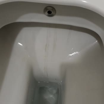 Turkuaz Seramik Klozetlerde Kalıcı Leke Sorunu Ve Müşteri Hizmetlerine Ulaşılamıyor