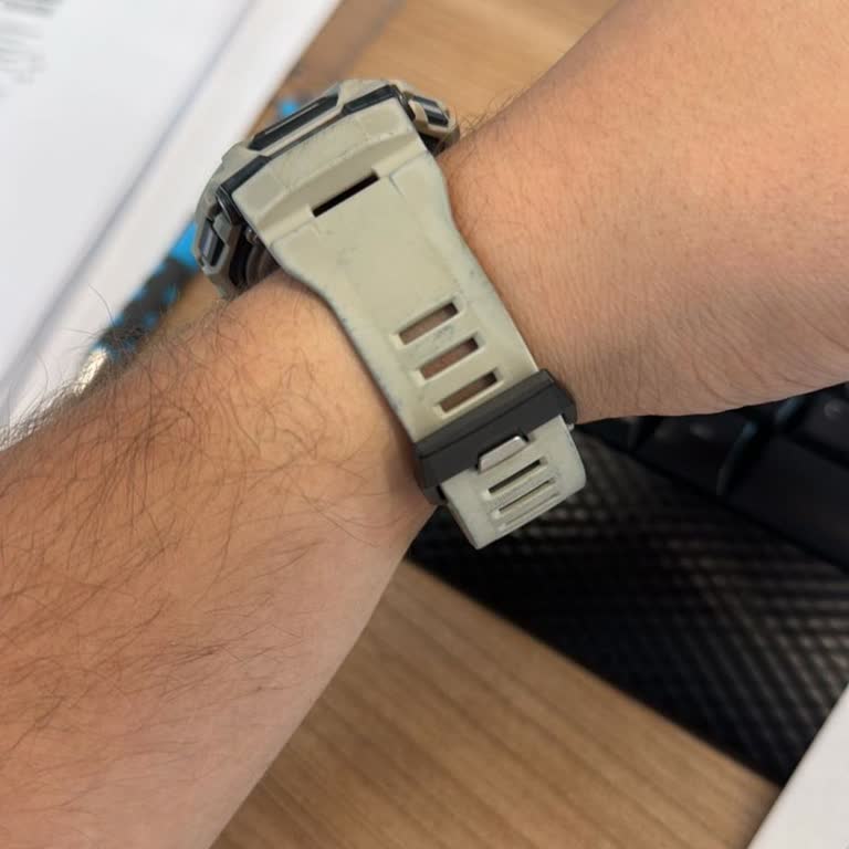 İki Ayda Renk Atan Saat Ve İlgisiz Müşteri Hizmeti