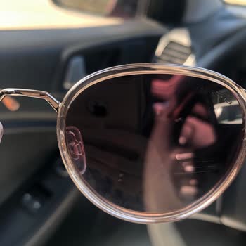 Gözlükteki Çizik Sorunu Ve Garanti Sürecinde Yaşanan Mağduriyet