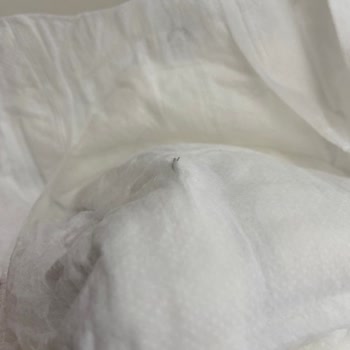 Bebek Bezinden Metal Tel Çıkması: Sağlık Ve Güvenlik Riski