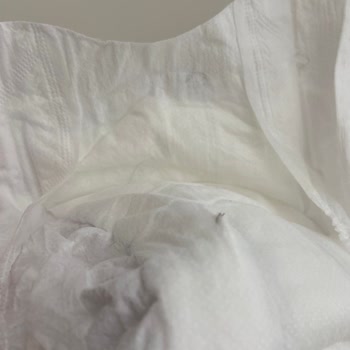 Bebek Bezinden Metal Tel Çıkması: Sağlık Ve Güvenlik Riski