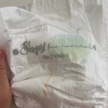 Bebek Bezinden Metal Tel Çıkması: Sağlık Ve Güvenlik Riski