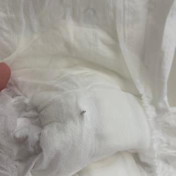 Bebek Bezinden Metal Tel Çıkması: Sağlık Ve Güvenlik Riski