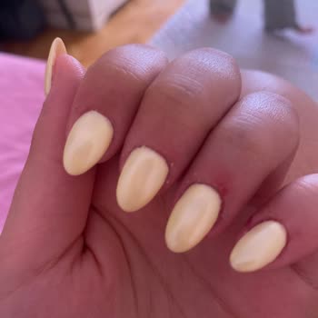 Protez Tırnak İşleminde Yamukluk, Ekstra Ücret Ve Çözüm Eksikliği