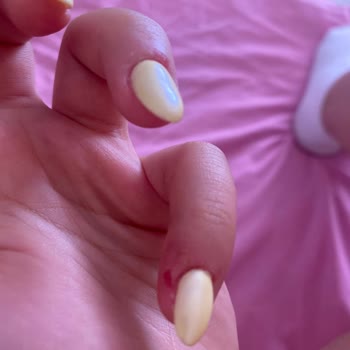 Protez Tırnak İşleminde Yamukluk, Ekstra Ücret Ve Çözüm Eksikliği