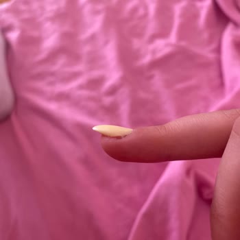 Protez Tırnak İşleminde Yamukluk, Ekstra Ücret Ve Çözüm Eksikliği