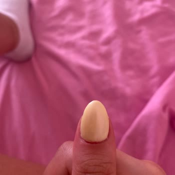 Protez Tırnak İşleminde Yamukluk, Ekstra Ücret Ve Çözüm Eksikliği