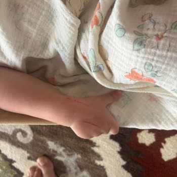 Aşısız Otel Kedisi Bebeğimi Tırmaladı, Acil Kuduz Aşısı Yaptırmak Zorunda Kaldık