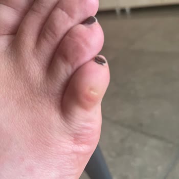 House Of Superstep Aldığım Converse Ayakkabı Ayağımı Yaraladı, Değişim Talep Ediyorum