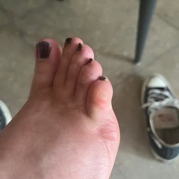 House Of Superstep Aldığım Converse Ayakkabı Ayağımı Yaraladı, Değişim Talep Ediyorum