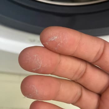 Arçelik Çamaşır Makinesi Sürekli Arıza Yapıyor, Servis Sorunumu Çözmüyor